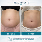 body sculpting machine​