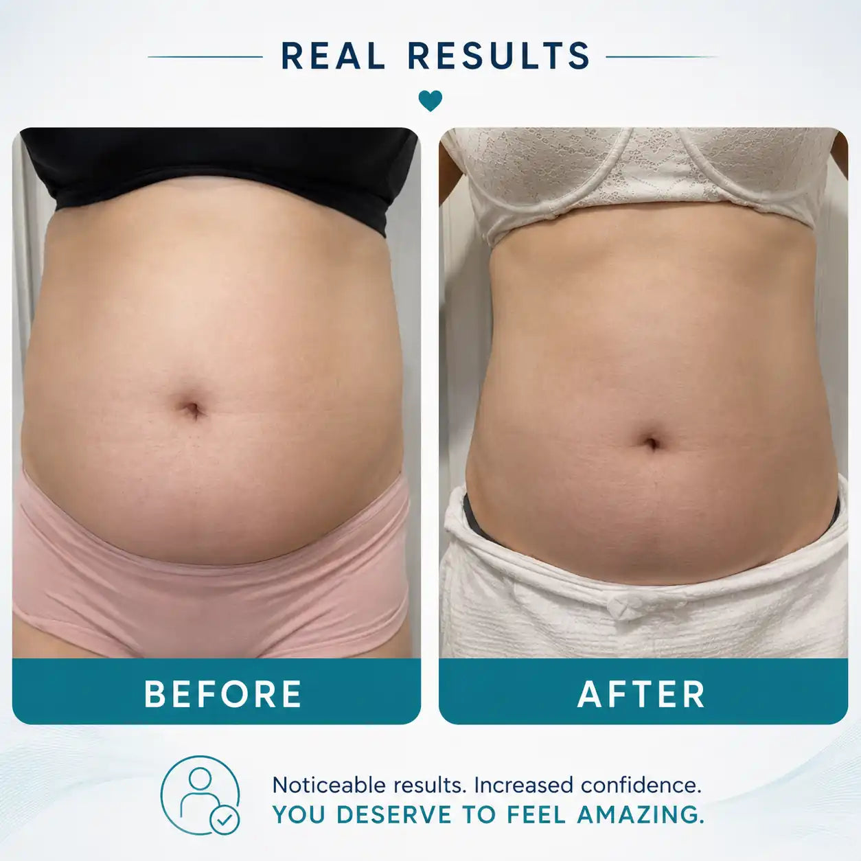 body sculpting machine​