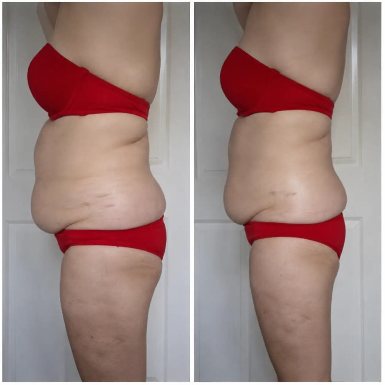 cavitation machine