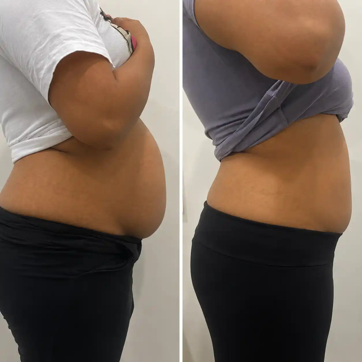 cavitation machine