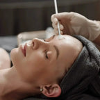 chemical peel training
