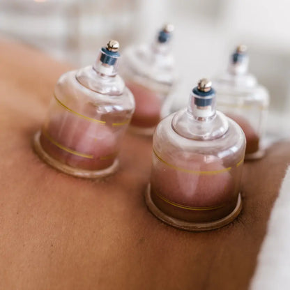 cupping therapy course