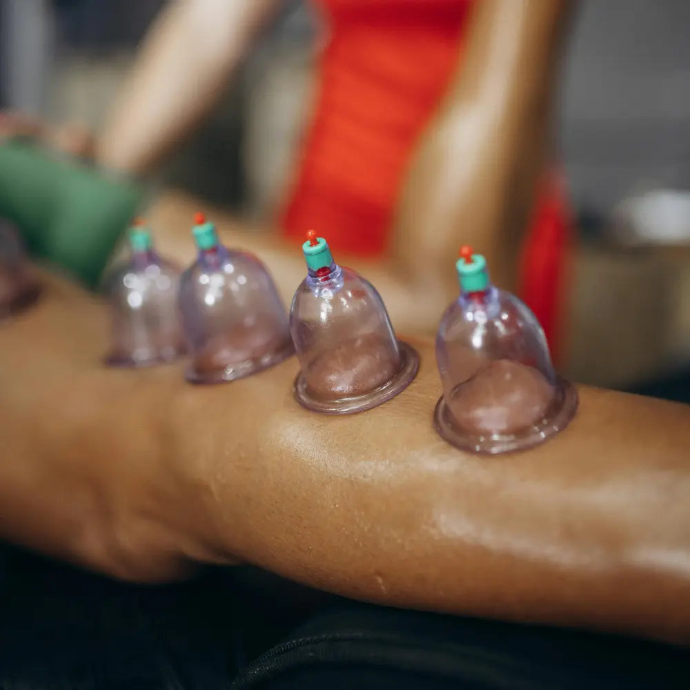 cupping therapy courses