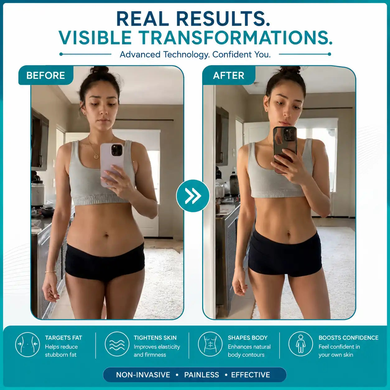 body sculpting machine