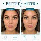 lift face machine