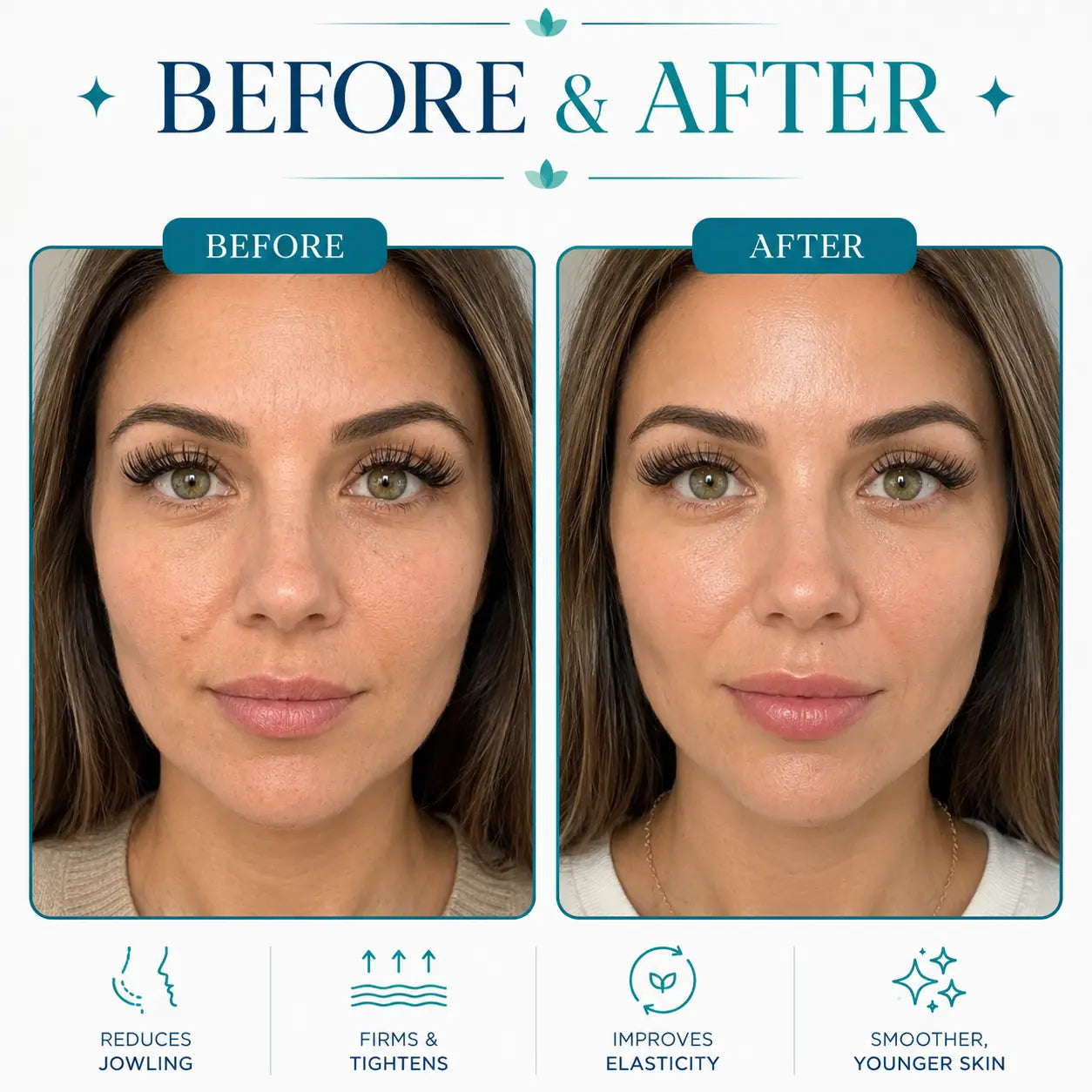 lift face machine