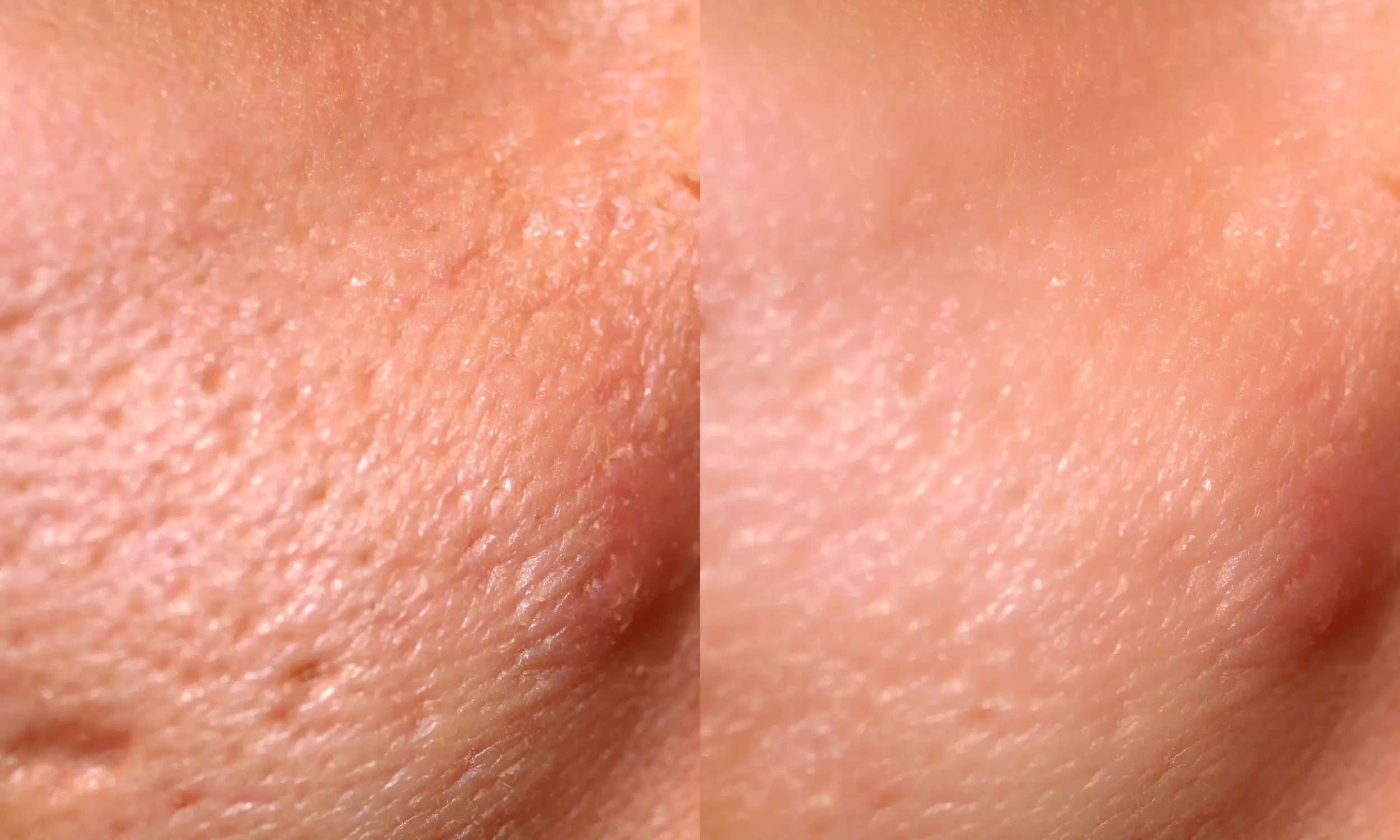 do high frequency wands work