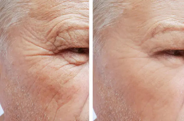 eye cream for wrinkles