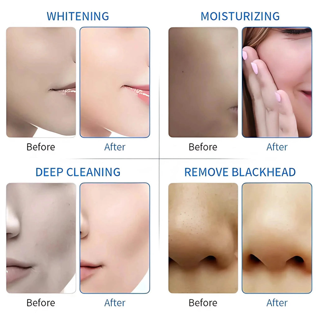 facial with ultrasound machine