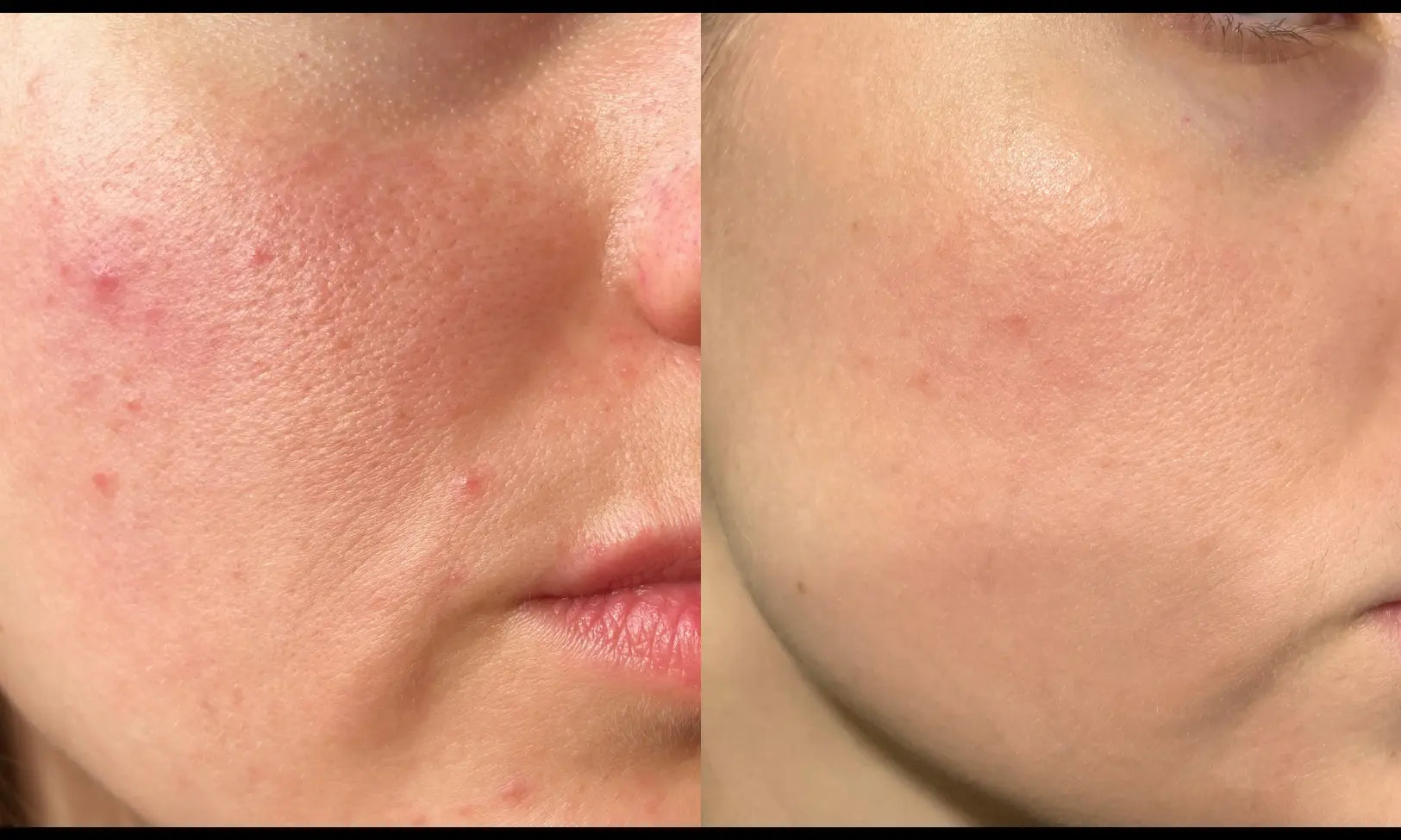 good eye cream for wrinkles