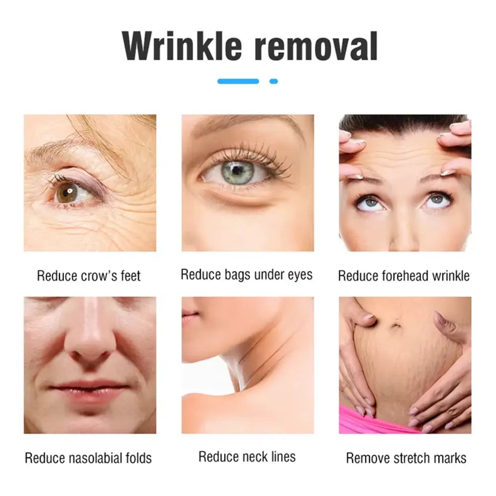 hifu machine professional