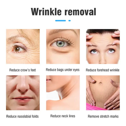 hifu machine professional