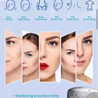 hifu treatment machine
