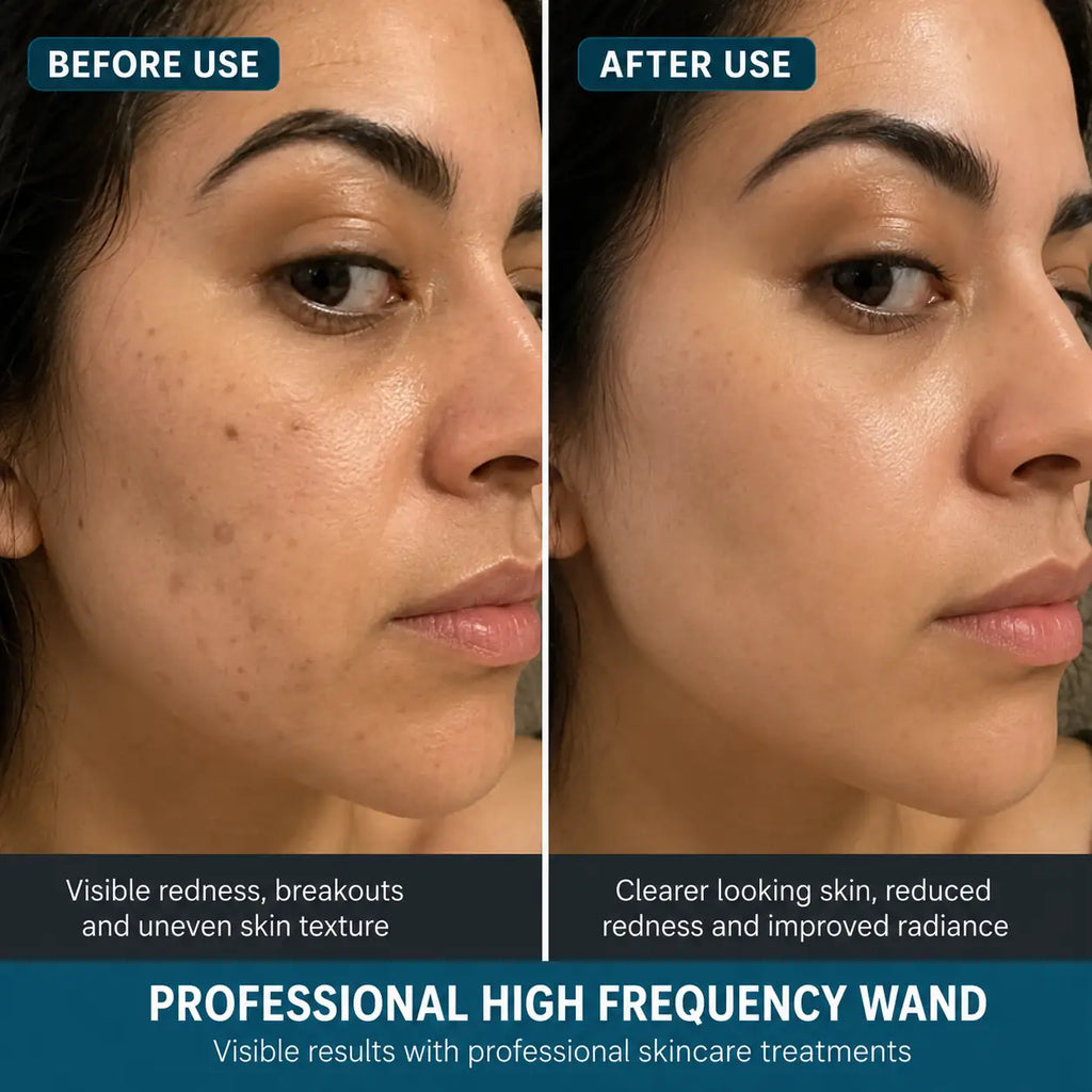 high frequency facial machine
