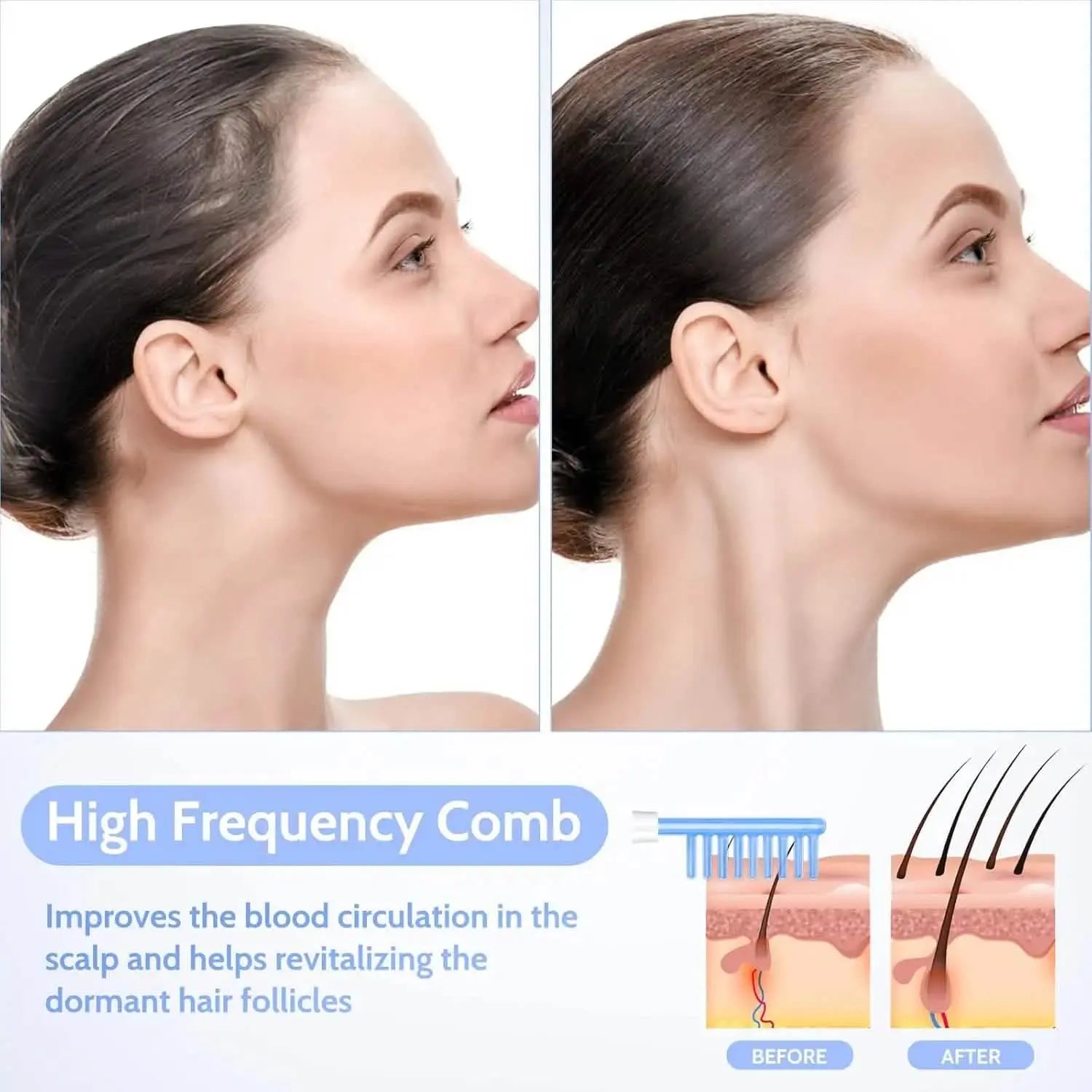 high frequency in facial