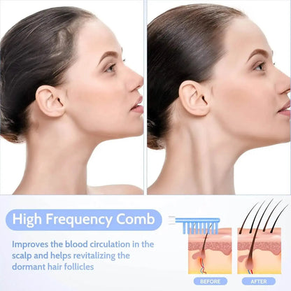 high frequency in facial