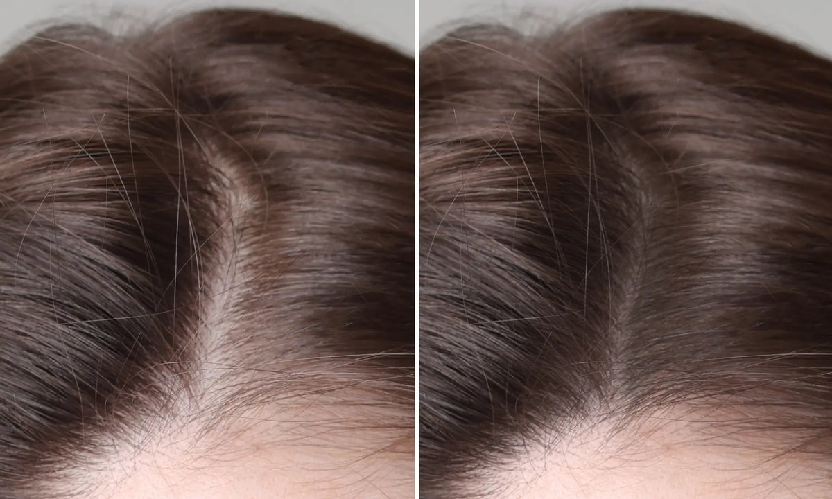 high frequency wand for hair