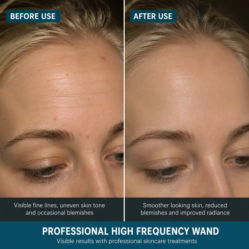 high frequency wand for hair​