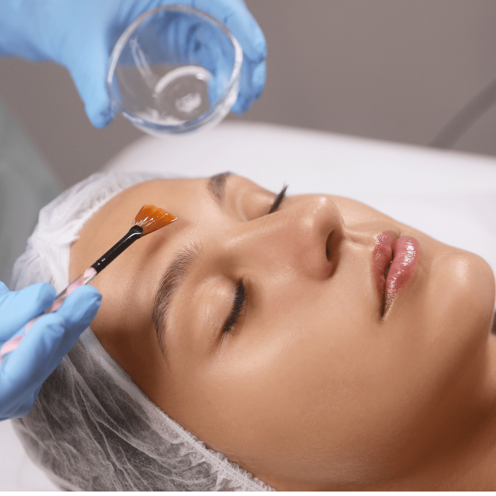 chemical peel course online