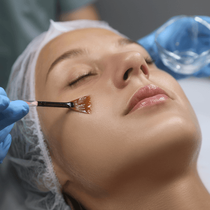 Chemical Peel Training