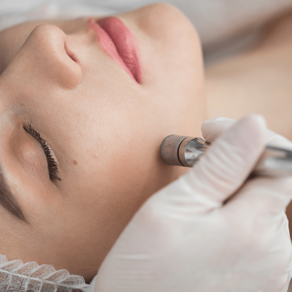 Microdermabrasion Course