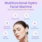 hydrodermabrasion facial