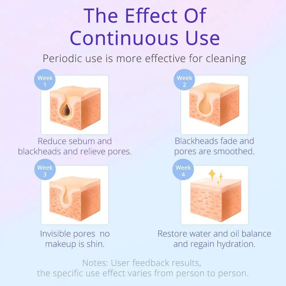 hydrodermabrasion facial machines