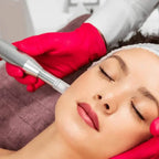 microneedling course near me