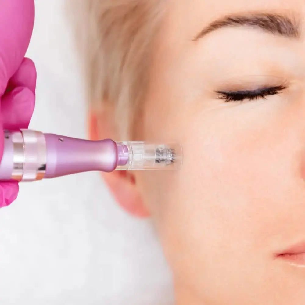 Microneedling Accredited Diploma Course | Lip Enhancement Courses ...