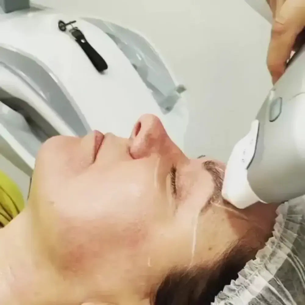 portable hifu machine