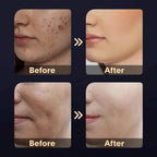 skin tightening home remedies