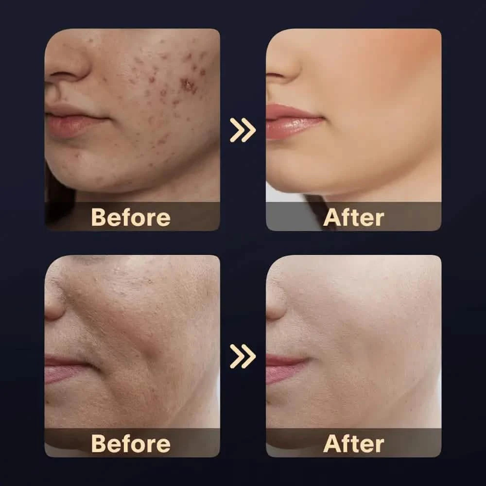 skin tightening home remedies
