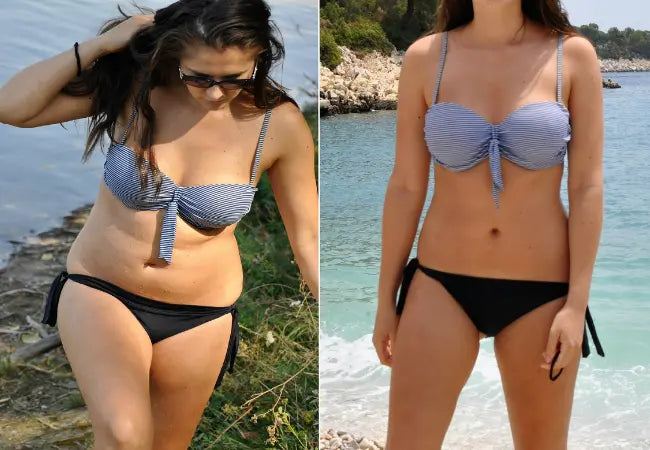 skin tightening machine for weight loss