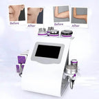 ultrasound and cavitation