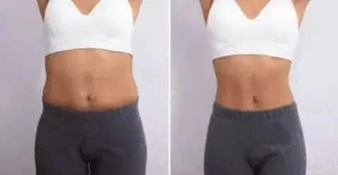 Anti Cellulite Machine UK